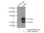 LIPH Antibody in Immunoprecipitation (IP)