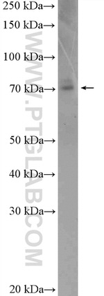 CCDC22 Antibody in Western Blot (WB)