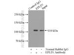 EPLIN Antibody in Immunoprecipitation (IP)