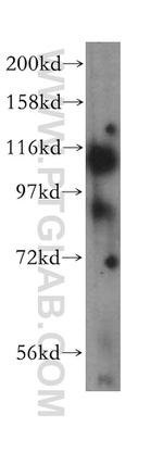 EPLIN Antibody in Western Blot (WB)