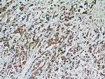 STAT2 Antibody in Immunohistochemistry (Paraffin) (IHC (P))