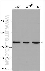 STAT2 Antibody in Western Blot (WB)