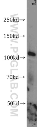 STAT2 Antibody in Western Blot (WB)