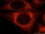 CKAP4 Antibody in Immunocytochemistry (ICC/IF)