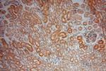 CKAP4 Antibody in Immunohistochemistry (Paraffin) (IHC (P))