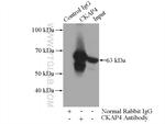 CKAP4 Antibody in Immunoprecipitation (IP)