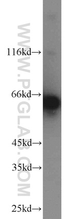 CKAP4 Antibody in Western Blot (WB)