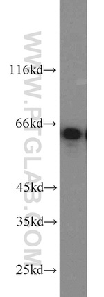 CKAP4 Antibody in Western Blot (WB)