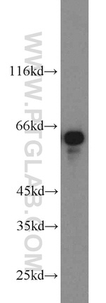 CKAP4 Antibody in Western Blot (WB)