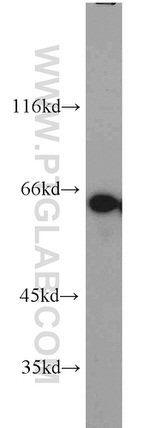 CKAP4 Antibody in Western Blot (WB)