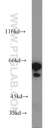 CKAP4 Antibody in Western Blot (WB)