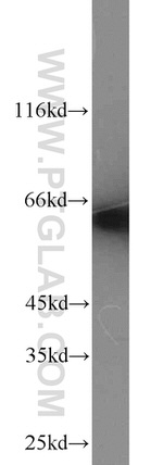 CKAP4 Antibody in Western Blot (WB)