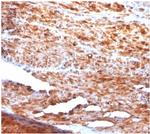 Desmin (Muscle Cell Marker) Antibody in Immunohistochemistry (Paraffin) (IHC (P))