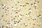 HSD17B8 Antibody in Immunohistochemistry (Paraffin) (IHC (P))