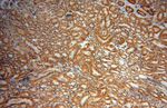 GPT2 Antibody in Immunohistochemistry (Paraffin) (IHC (P))