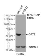 GPT2 Antibody in Western Blot (WB)