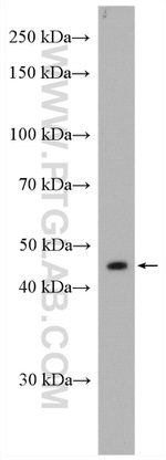 GPT2 Antibody in Western Blot (WB)