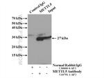 METTL5 Antibody in Immunoprecipitation (IP)