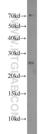 SNRPB Antibody in Western Blot (WB)