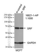 SRF Antibody in Western Blot (WB)