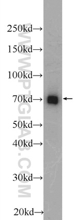 SRF Antibody in Western Blot (WB)