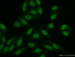 NCAPD3 Antibody in Immunocytochemistry (ICC/IF)