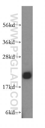 NIP7 Antibody in Western Blot (WB)