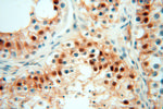 USP13 Antibody in Immunohistochemistry (Paraffin) (IHC (P))