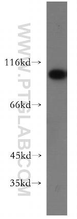 USP13 Antibody in Western Blot (WB)