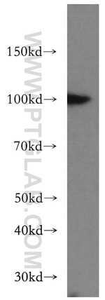 USP13 Antibody in Western Blot (WB)