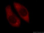 RAB3C Antibody in Immunocytochemistry (ICC/IF)