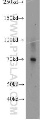 PROS1 Antibody in Western Blot (WB)