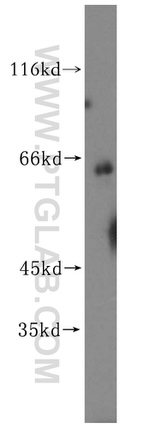 CES1 Antibody in Western Blot (WB)