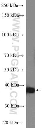 HLA-G Antibody in Western Blot (WB)