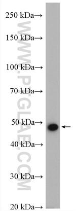 Kir6.2 Antibody in Western Blot (WB)