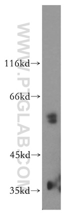 vitamin D binding protein Antibody in Western Blot (WB)