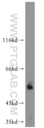 vitamin D binding protein Antibody in Western Blot (WB)