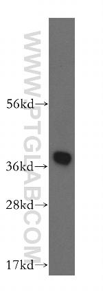 HSD17B7 Antibody in Western Blot (WB)