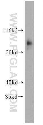 TBX2 Antibody in Western Blot (WB)