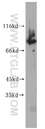 TBX2 Antibody in Western Blot (WB)