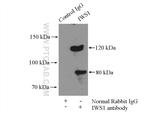 IWS1 Antibody in Immunoprecipitation (IP)