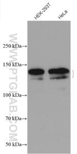 SAPS3 Antibody in Western Blot (WB)
