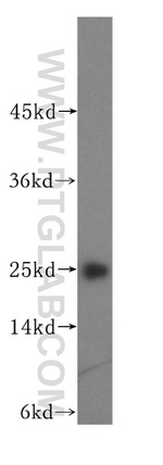 N6AMT2 Antibody in Western Blot (WB)