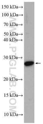 N6AMT2 Antibody in Western Blot (WB)