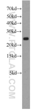 RPS5 Antibody in Western Blot (WB)