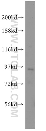 NVL Antibody in Western Blot (WB)