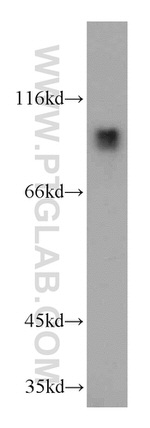 MGAT5B Antibody in Western Blot (WB)