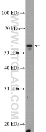 CD14 Antibody in Western Blot (WB)