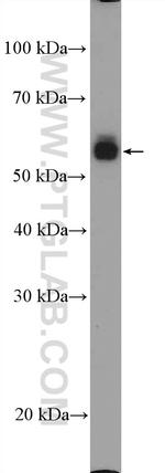 CD14 Antibody in Western Blot (WB)