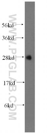 METTL7B Antibody in Western Blot (WB)